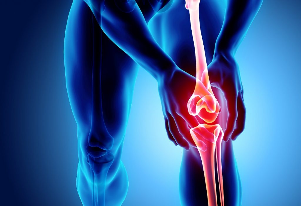 Significant knee pain